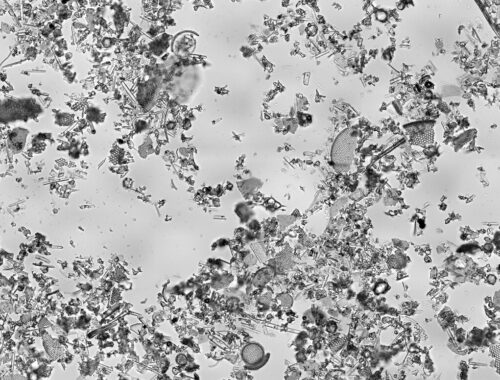 Terre de diatomée vue au microscope